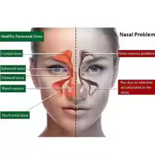 20ml Natural Herbal Nasal Care Spray – Sinus & Congestion Relief
