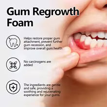 Gum Care & Teeth Whitening Foam – Oral Cleaning & Gum Protection