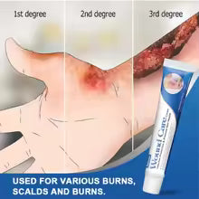 Sumifun Burn & Scald Care Cream – 1/2/3 Pcs