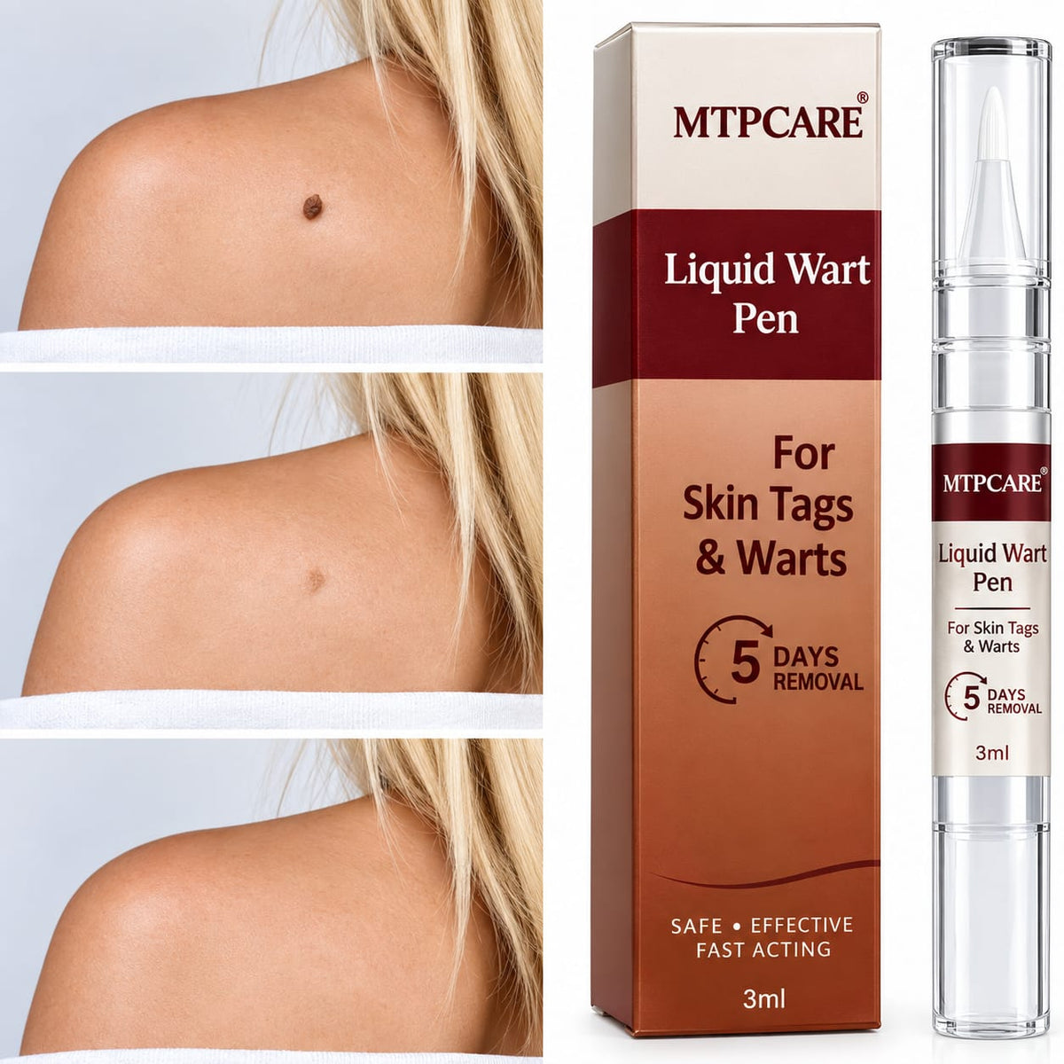 JAYSUING Liquid Wart Remover – Fast-Acting Wart & Skin Tag Treatment | 30ml