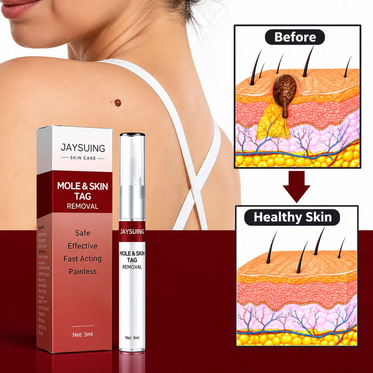 JAYSUING Liquid Wart Remover – Fast-Acting Wart & Skin Tag Treatment | 30ml